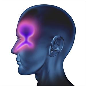 Chronische Sinusitis Symptomen - Prevention And Cure Of Chronic Sinusitis Symptoms