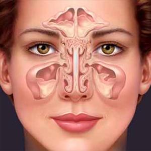 Maxillary Sinuses Symptoms - Nasal Congestion- The Role Of Humidity Control