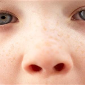 Sinusitis Facial Numbness - Various Causes And Possible Treatment Of Sinus Infection