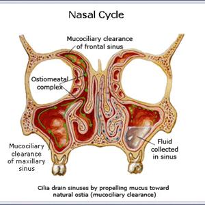 Healing Sinuses - Find Natural Sinus Remedies For Effective Relief