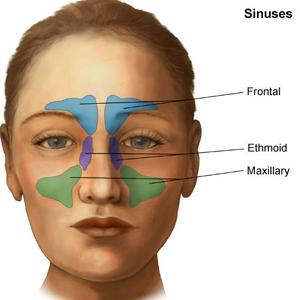 Help For Sinusitis - Acid Reflux And Sinusitis