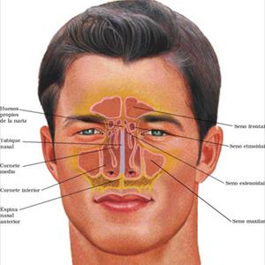 Sinusitis Treatment - Maxillary Sinus Surgery