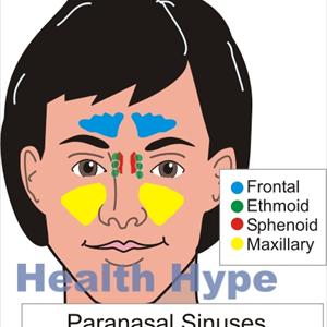  Acid Reflux And Sinusitis