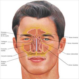 Paranasal Sinus Disease 