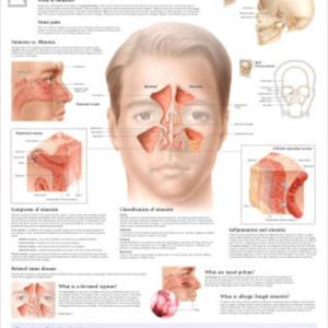 Dry Eyes Sinusitis 